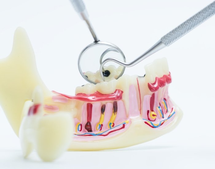 TMJ Nerve Damage Symptoms: Causes, Signs, Treatment & When to Seek Help